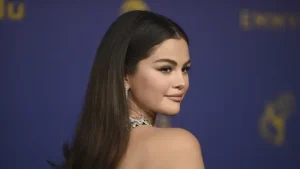 Selena Gomez Mengidap Artritis akibat Penyakit Lupus
