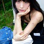 Nana Ternyata Cedera Saat Lawan Perampok