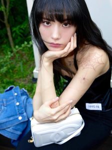 Nana Ternyata Cedera Saat Lawan Perampok