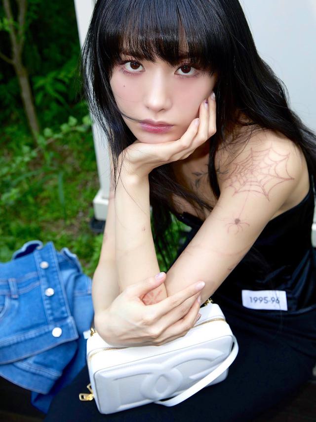 Nana Ternyata Cedera Saat Lawan Perampok